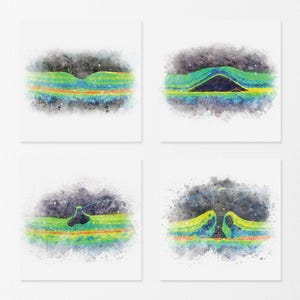 May include: A set of four square medical prints featuring colorful cross-sectional scans of the human eye. Each image displays layers of the retina in shades of green, yellow, and blue against a dark, textured, watercolor-style background.