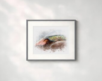 Glaucoma art print depicting closed angle in the eye. Watercolor style glaucoma specialist wall decor and gift - 077
