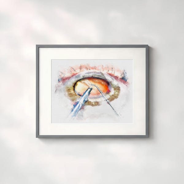 Eye surgeon gift cataract surgery art print, mixed media style eye art, eye doctor office décor - 606