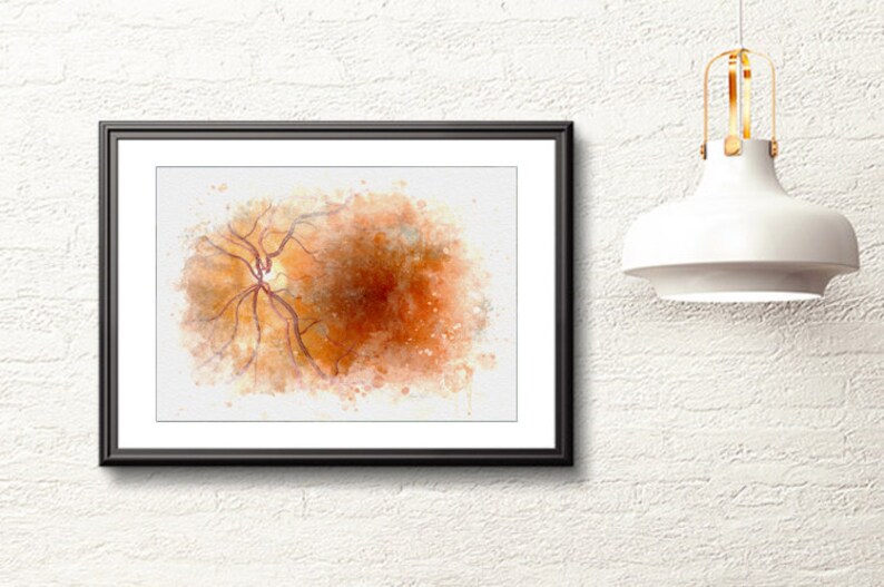 Medical student graduate gift eye wall art