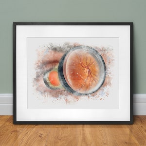 Optometry gift art print, ophthalmoscopy eye exam art, ophthalmology and optometry gifts, retina specialist eye doctor decor - 148