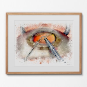 Cataract surgery watercolor style eye art print for eye doctor&#39;s office decor, a gift for an ophthalmologist and eye surgery décor - 160