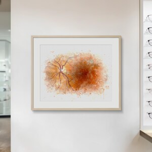 Optometry decor retina painting