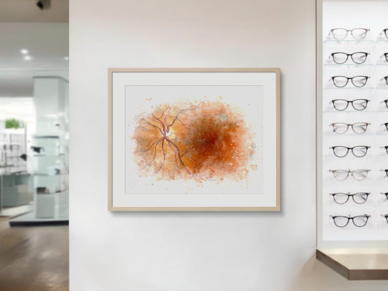Optometry decor retina painting