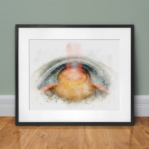 Cataract surgeon gift, watercolor-style eye surgery art print, laser assisted cataract surgery print, eye surgery décor - 032