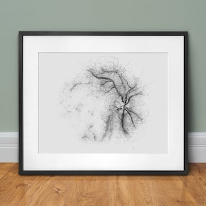 Retina Eye Anatomy Line Art Print Eye Doctor Gift - 1001