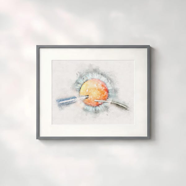 Cataract surgeon gift Phacoemulsification in cataract surgery watercolor style art print doctors office décor and eye surgeon's gift - 170