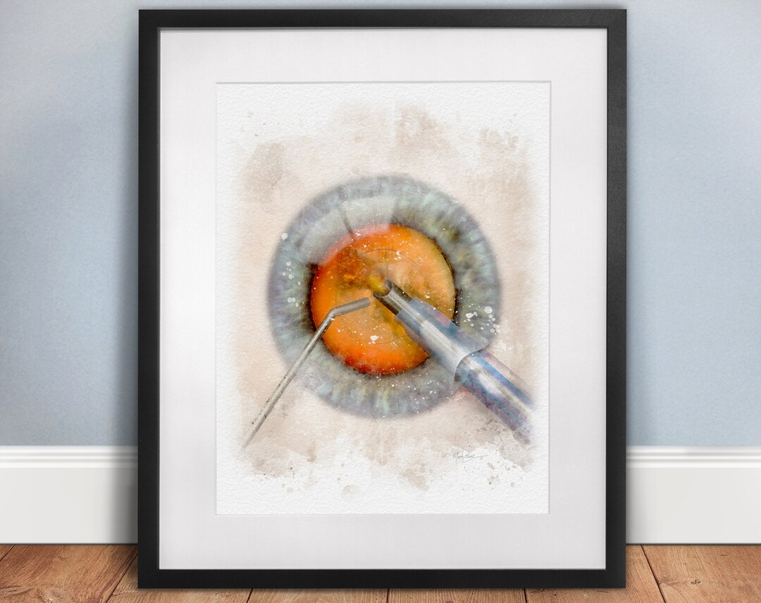 Eye Doctor Gifts Cataract Surgery Phacoemulsification Etsy