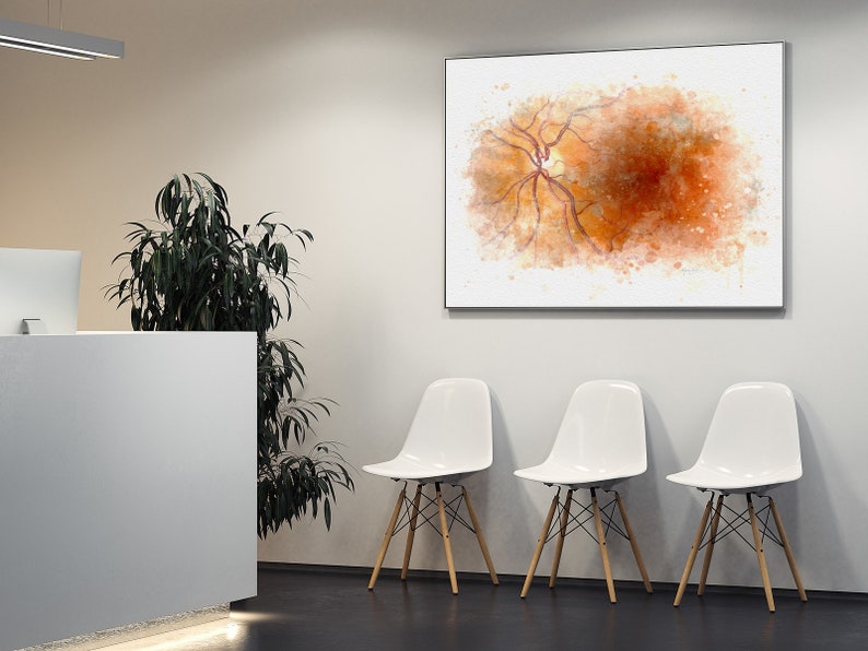 Waiting room wall art print for retina doctor gift