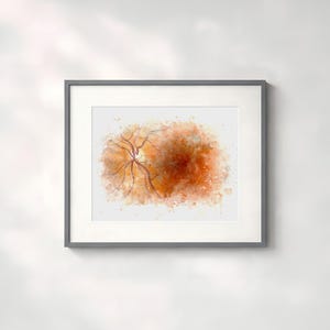 Retina painting for eye doctor decor