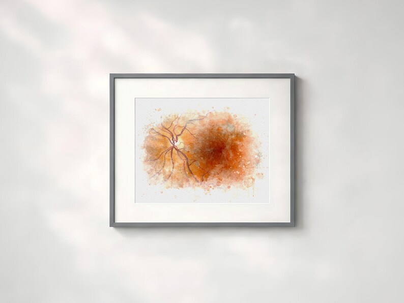 Retina painting for eye doctor decor