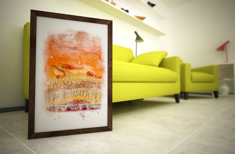 Macular Degeneration Watercolor Style Art Print for Eye Doctor Office Decor 208 Retina Doctor Gift