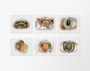 Cataract Surgery Art Prints Collection – Watercolor style art prints for Ophthalmology office wall decor, hand-signed giclée set of six