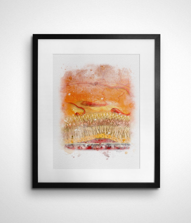 Macular Degeneration Watercolor Style Art Print for Eye Doctor Office Decor 208 Retina Doctor Gift