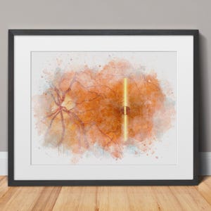 Macular hole eye art print depicting a slit lamp exam. Optometrist and ophthalmologist retina specialist gift, eye doctors office - 119a