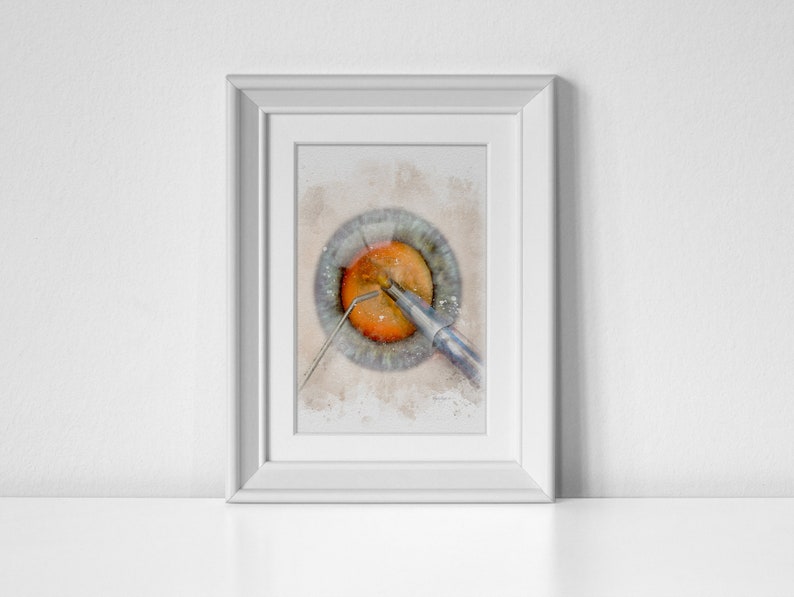 Eye Doctor Gifts Cataract Surgery Phacoemulsification Etsy