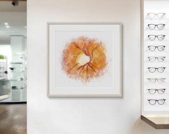 Optic Nerve Glaucoma Fine Art Print, Watercolor Style Wall Decor for Optometry Office - 079
