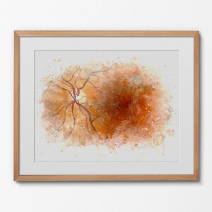Eye anatomy art print for eye doctor decor