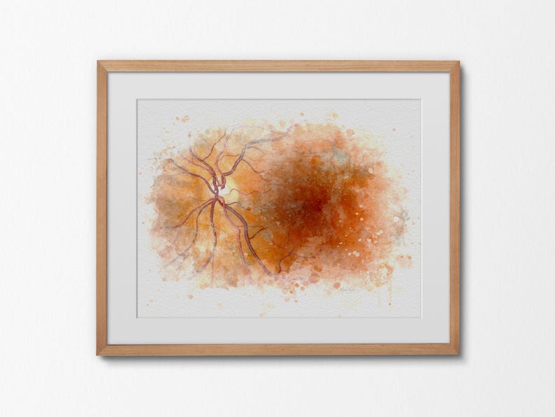 Eye anatomy art print for eye doctor decor