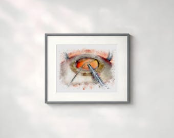 Cataract surgery watercolor style ophthalmology art print for eye doctor's gift and office decor - 160