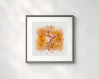 Eye doctor gift glaucoma optic nerve wall art print in watercolor style - 080