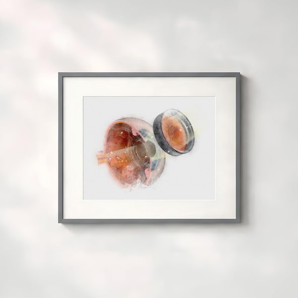 Eye doctor gift, ophthalmoscopy eye exam watercolor style retina art print, eye doctor decor ophthalmology resident gift - 144