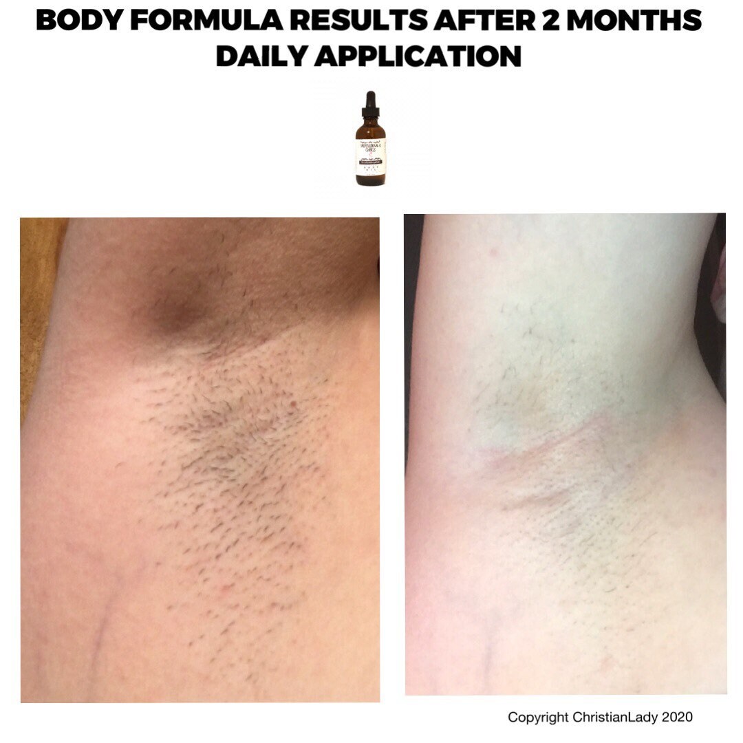 Unwanted Hair Removal/natural Hair Inhibitor for Men and - Etsy UK Unwanted Hair Removal/natural Hair Inhibitor for Men and - Etsy UK