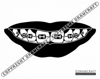 Download Braces Teeth Etsy