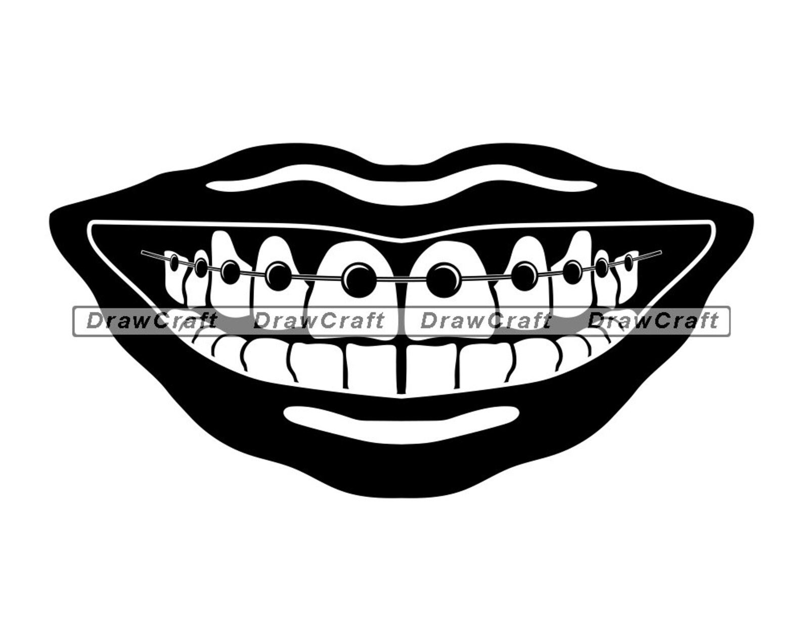 Braces SVG Teeth Svg Teens Svg Dentist Svg Braces Cut | Etsy