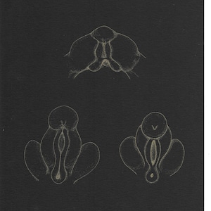 Geschlechterdifferenzierung| Geburtsplakat | Wanddekoration Baby | Feministische Kunst | Schwangerschaft | Intersex-| schwangere | Geschlechter | Anatomie