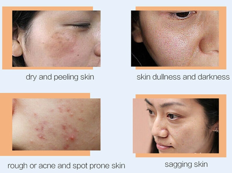 Hyaluronic Acid Marine Collagen Face Dark Eye Creams Etsy