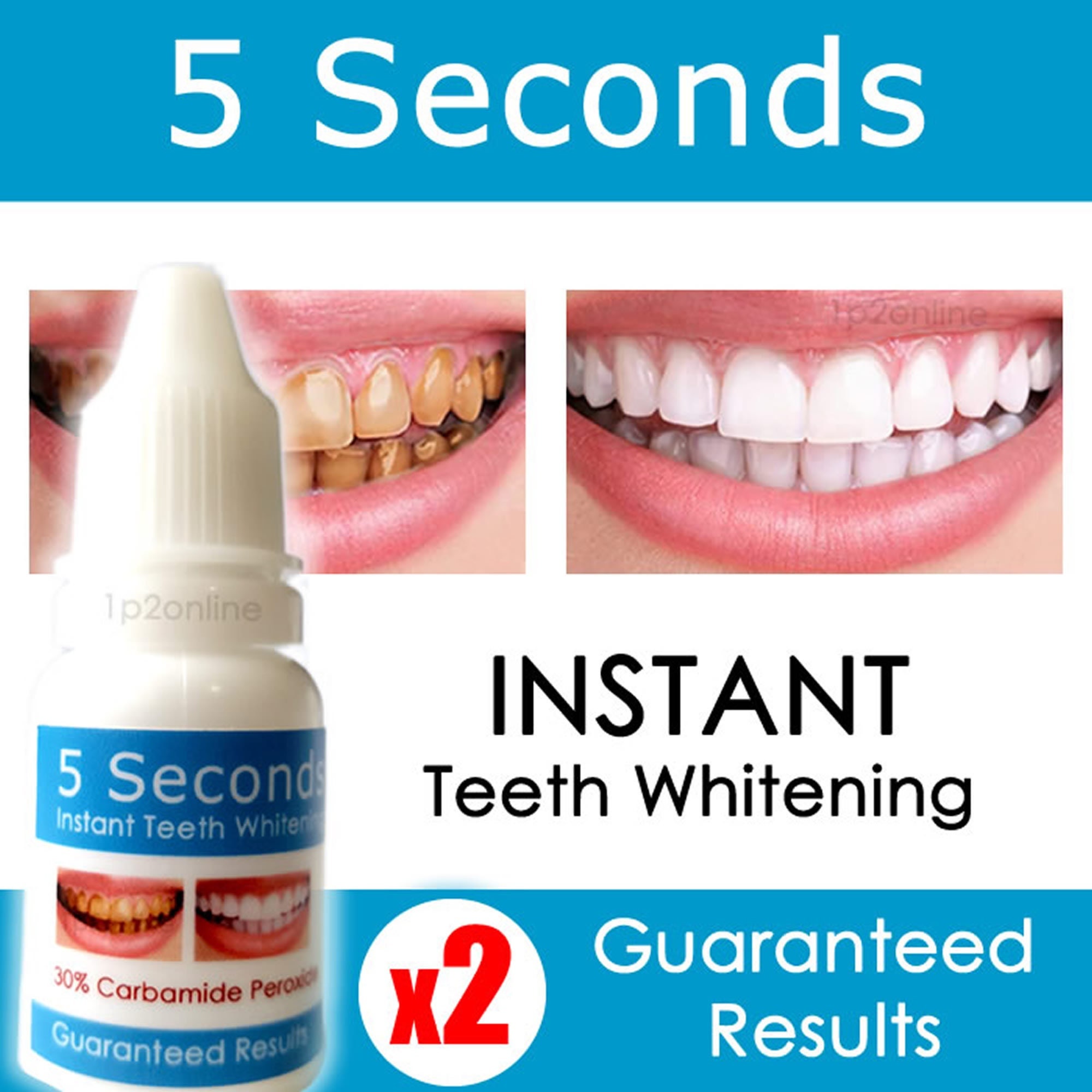 X2 Instant Teeth Whitening Kit Best Gel 30 Carbamide Peroxide Smile
