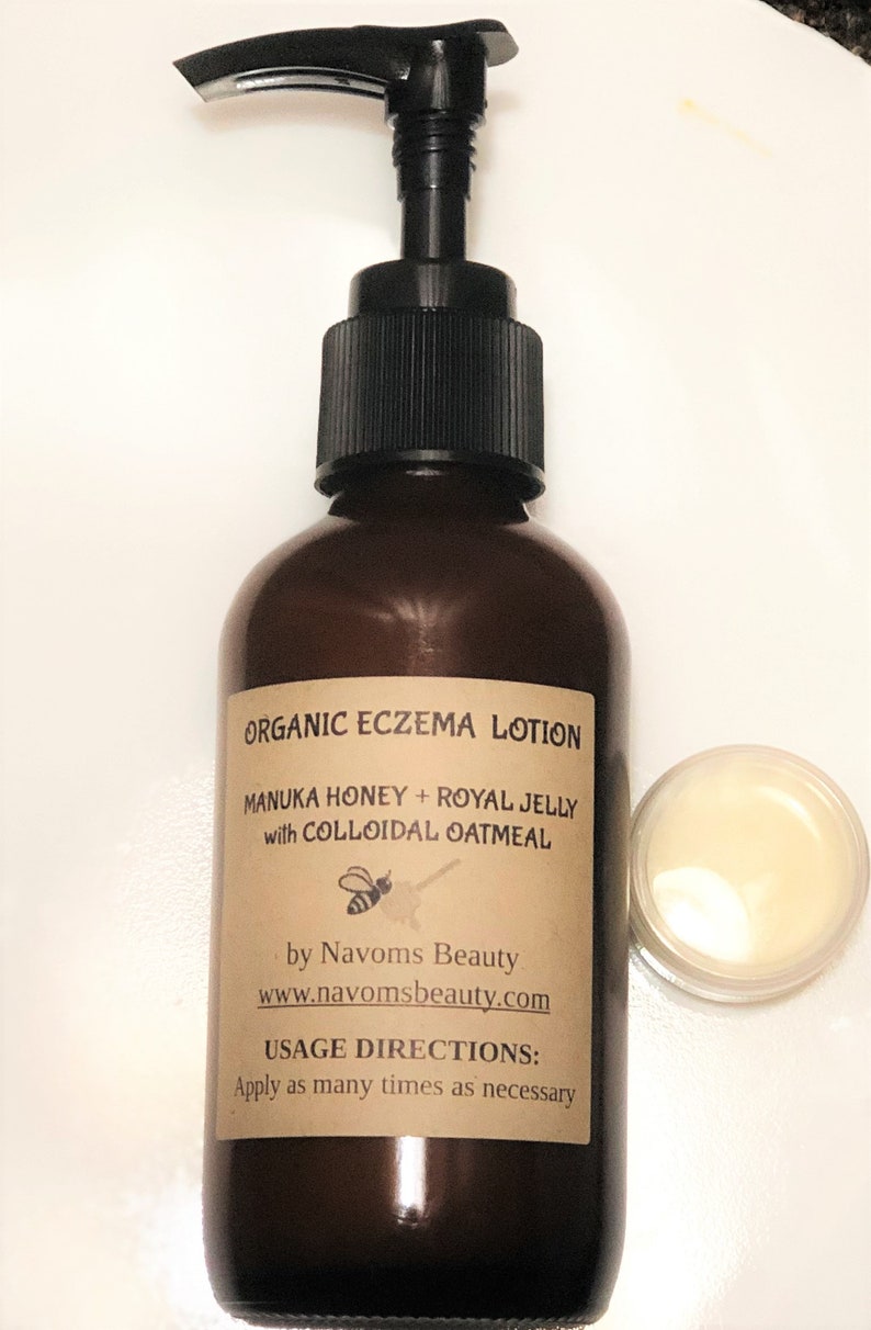 Organic Eczema Relief Lotion Eczema Cream Psoriasis Skin Etsy