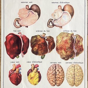 Menschlicher Körper: Alkoholismus, Sehen / Menschlicher Körper, Alkoholismus, - Altes Schulplakat Rossignol Sciences 21-22, 1950 - Altes Schulplakat