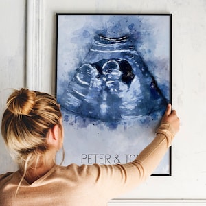 Custom ultrasound watercolor portrait, Baby ultrasound painting, New parent gift, Baby room décor, Baby shower gift for friend, image 3
