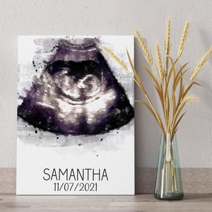 Custom ultrasound watercolor portrait, Baby ultrasound painting, New parent gift, Baby room décor, Baby shower gift for friend, image 5