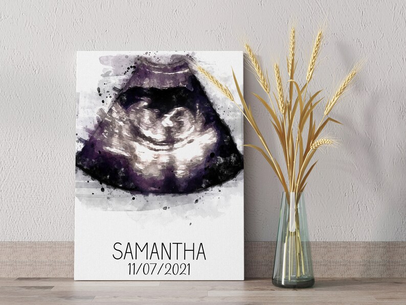 Custom ultrasound watercolor portrait, Baby ultrasound painting, New parent gift, Baby room décor, Baby shower gift for friend, image 5