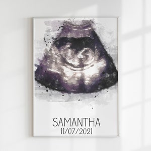 Custom ultrasound watercolor portrait, Baby ultrasound painting, New parent gift, Baby room décor, Baby shower gift for friend, image 4