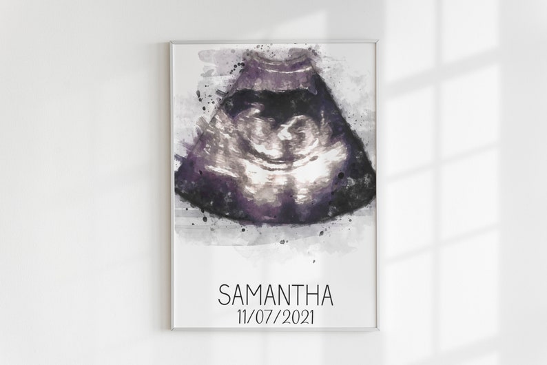 Custom ultrasound watercolor portrait, Baby ultrasound painting, New parent gift, Baby room décor, Baby shower gift for friend, image 4