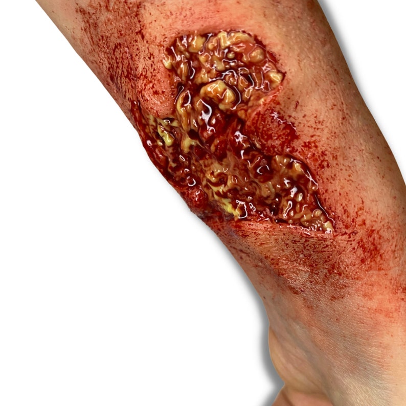 May include: A close-up of a leg with a realistic, gory wound. The wound is a deep, open sore with exposed tissue, blood, and a yellowish discharge. The surrounding skin is red and bruised, creating a gruesome effect.