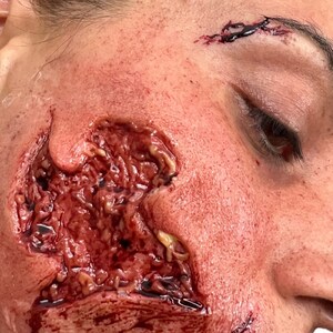 May include: A close-up of a face with a realistic wound prosthetic. The prosthetic features a deep, open wound with exposed tissue and blood. The skin around the wound is red and irritated, with additional cuts above the eye.