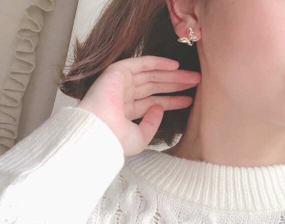 925 silver deals allergy