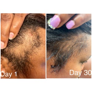 Hair Growth Oil (Wish)