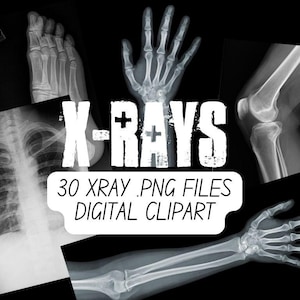 May include: A collection of black and white X-ray images featuring a human hand, foot, knee, and chest. The central white text reads X-RAYS 30 XRAY .PNG FILES DIGITAL CLIPART. These medical diagnostic images are presented as a digital graphic set.