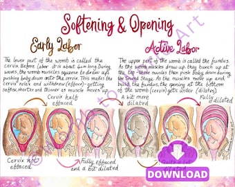 Hypnobirthing Cervical Dilation Art: Labor Education Handouts (PDF Download)