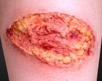 Infected Fatty Tissue Wound Silicone Prosthetic - Special Effects Makeup SFX Halloween Costume