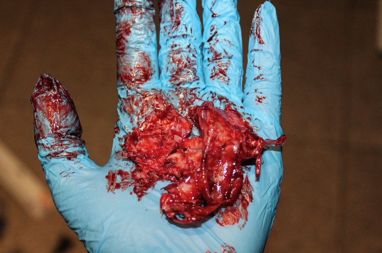 Bloody Brain Matter for Film and TV, Halloween, Zombie and Special Effects Makeup, Medical and Forensic Training, First Aid, SFX, Prop crime