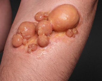 Infected Boils Silicone Prosthetic - Fake Zombie Makeup Halloween SFX Special Effects