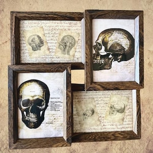 Diagrama médico de moldura de colagem de crânio e cérebro antigo. Autópsia, cirurgia, cartões educacionais, arte, adereço de terror, boticário, Greys Anatomy