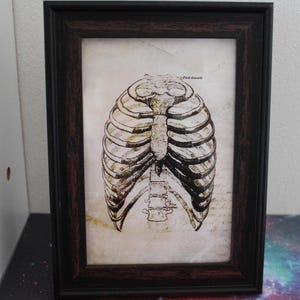 Greys Anatomy Ribs 2 Diagrama Moldura Detalhado Médico Autópsia cirurgia cartão educacional, desenho arte medicina arte, horror prop, boticário
